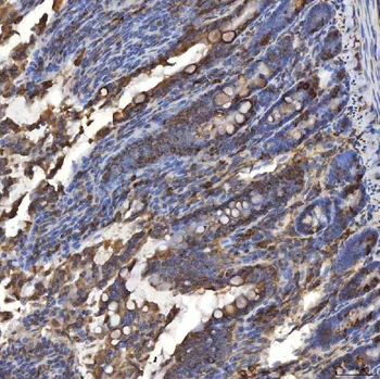 Anti-TXNDC5 Antibody