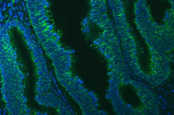 Anti-TXNDC5 Antibody