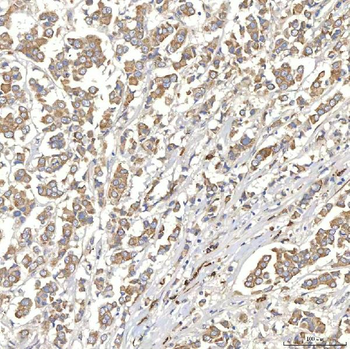 Anti-TXNDC5 Antibody