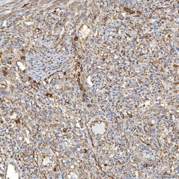Anti-TXNDC5 Antibody