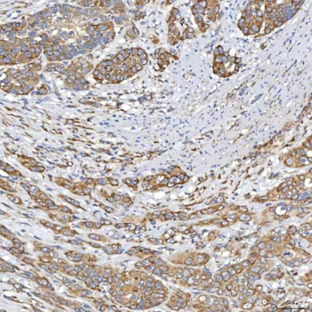 Anti-TXNDC5 Antibody