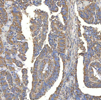 Anti-TXNDC5 Antibody