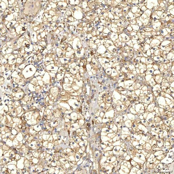 Anti-TXNDC5 Antibody