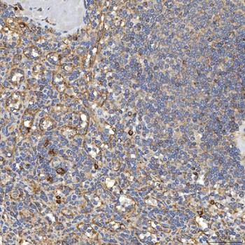 Anti-TXNDC5 Antibody