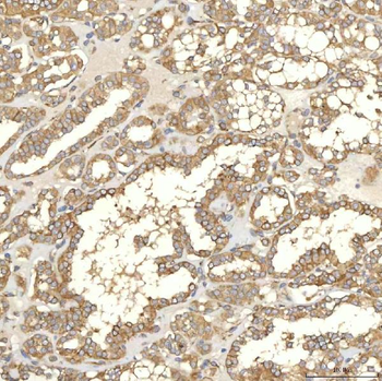 Anti-TXNDC5 Antibody