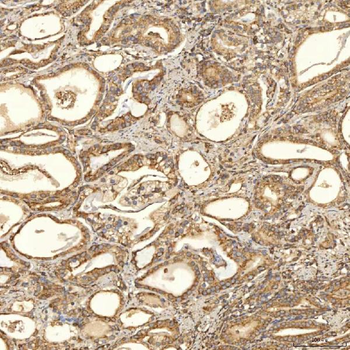 Anti-TST Antibody