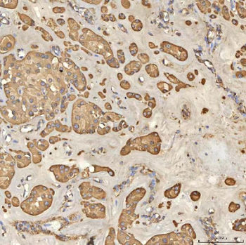 Anti-TST Antibody