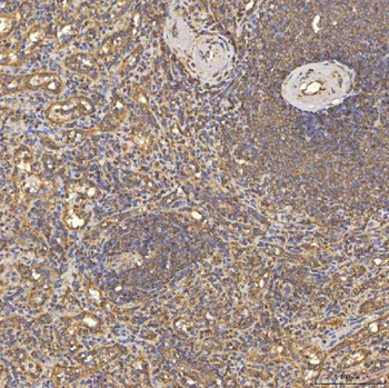 Anti-TST Antibody
