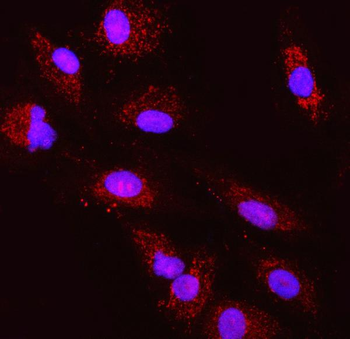 Anti-TST Antibody