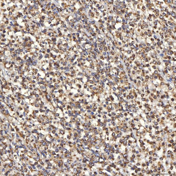 Anti-TST Antibody