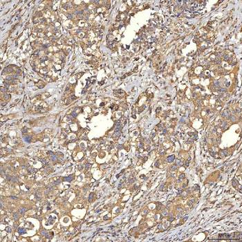 Anti-TST Antibody