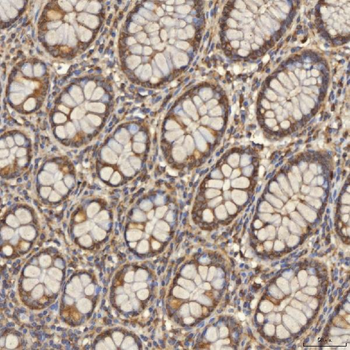 Anti-TST Antibody