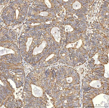 Anti-TST Antibody