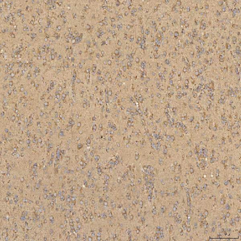 Anti-TST Antibody