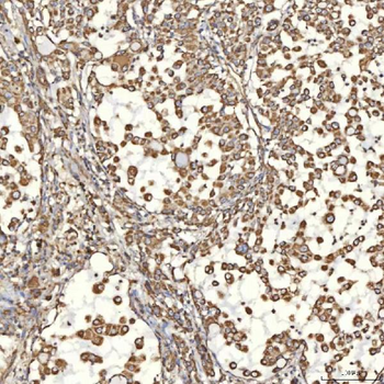Anti-TST Antibody