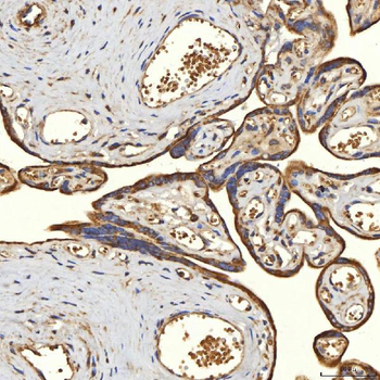 Anti-TST Antibody