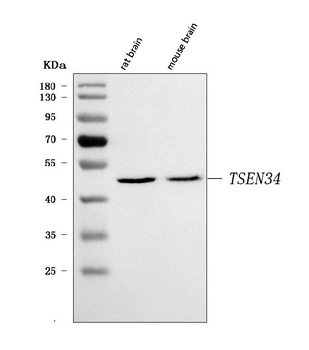 TSEN34 Antibody