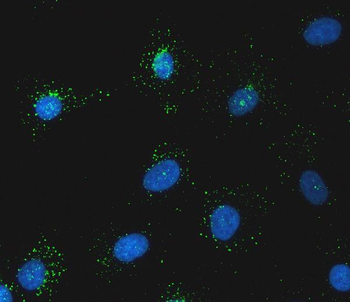 Anti-SNX1 Antibody