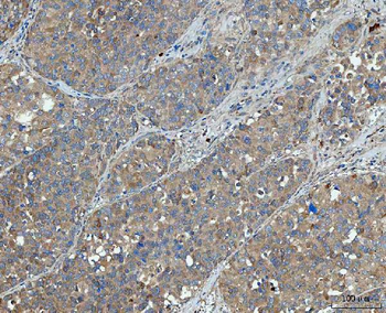 Anti-SNX1 Antibody