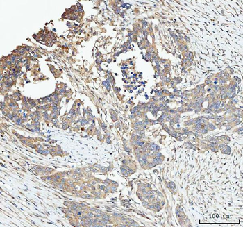 Anti-SNX1 Antibody