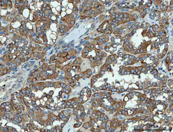 Anti-SNX1 Antibody