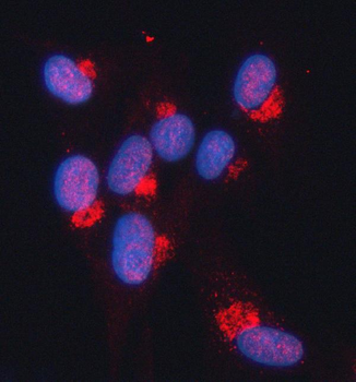 Anti-SNURPORTIN1/SNUPN Antibody