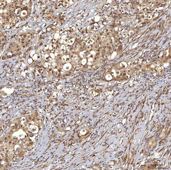 Anti-Sm-D3/SNRPD3 Antibody