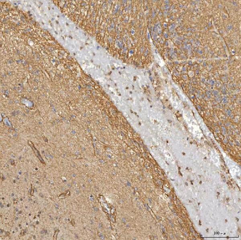 Anti-Sm-D3/SNRPD3 Antibody