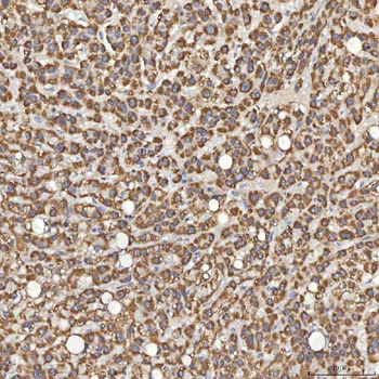 Anti-Sm-D3/SNRPD3 Antibody