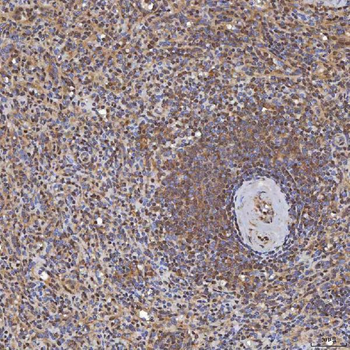 Anti-Sm-D3/SNRPD3 Antibody