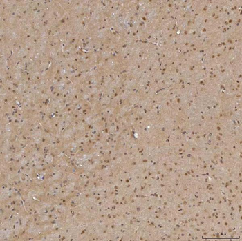 Anti-Sm-D3/SNRPD3 Antibody