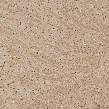 Anti-Sm-D3/SNRPD3 Antibody