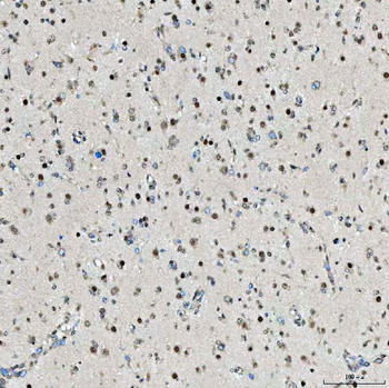 Anti-SNRPD2 Antibody