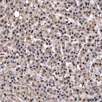 Anti-SNRPD2 Antibody