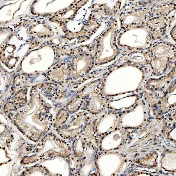 Anti-SNRPD2 Antibody