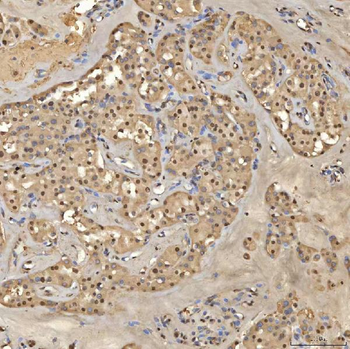 Anti-SNRPD2 Antibody