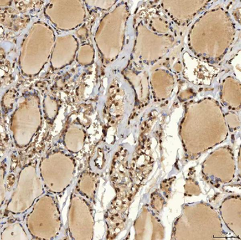 Anti-SNRPD2 Antibody