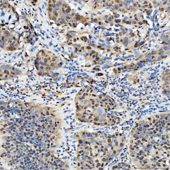 Anti-SNRPD2 Antibody