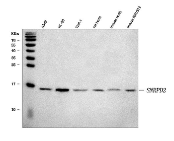 Anti-SNRPD2 Antibody