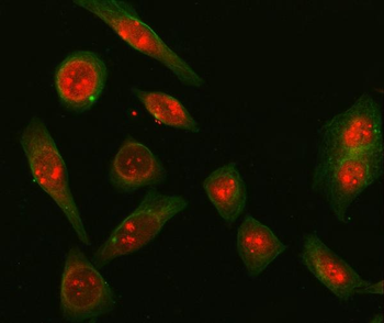 Anti-SNRPD2 Antibody