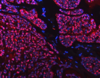 Anti-SNRPD2 Antibody