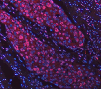 Anti-SNRPD2 Antibody