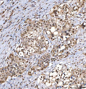 Anti-SNRPD2 Antibody