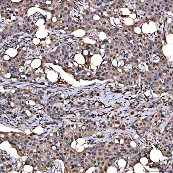 Anti-SNRPD2 Antibody