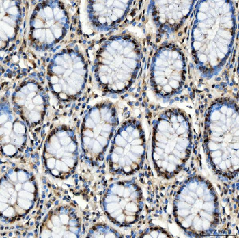 Anti-SNRPD2 Antibody