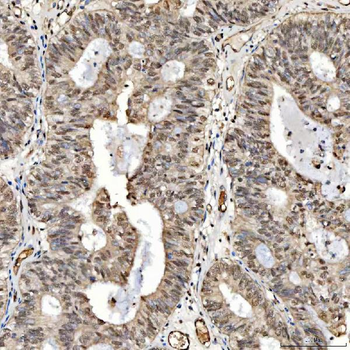 Anti-SNRPD2 Antibody