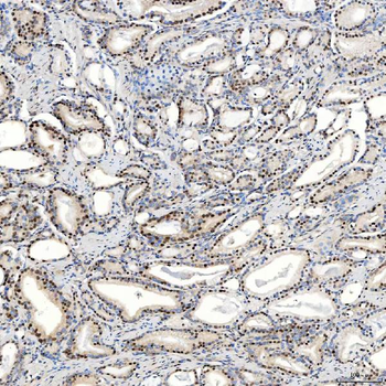 Anti-U1-C/SNRPC Antibody