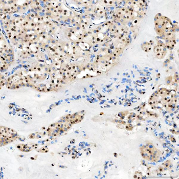 Anti-U1-C/SNRPC Antibody