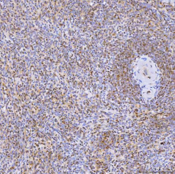 Anti-U1-C/SNRPC Antibody