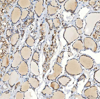 Anti-U1-C/SNRPC Antibody